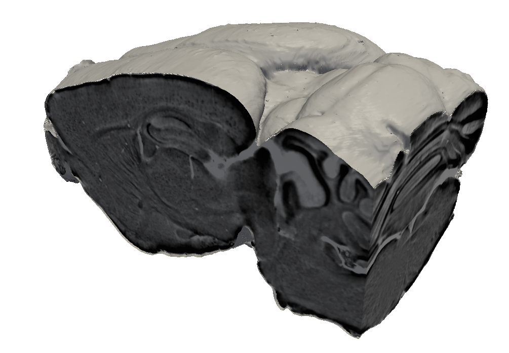 Virtueller Schnitt durch die aus den Ergebnissen der Phasenkontrastmessungen rekonstruierten Tomografiedaten. Die Methode erlaubt es, in das Innere des Gehirns zu sehen und die Plaques sichtbar zu machen, ohne dass das Gehirn in Scheiben geschnitten werden müsste. (Abbildung: Paul Scherrer Institut/B. Pinzer)