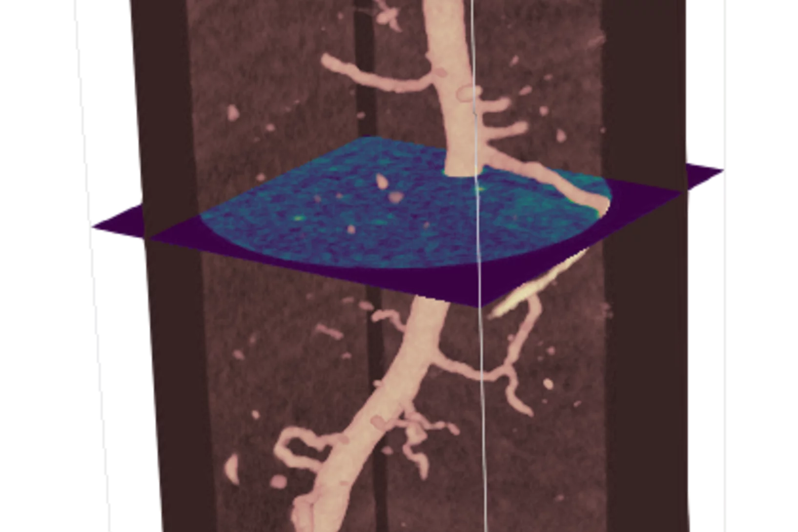 Root tomography